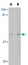 PAB13347 - LGI4