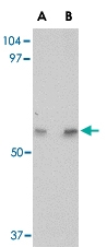 PAB13348 - LGI4