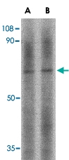 PAB13352 - LGI2