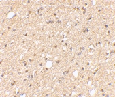 PAB13352 - LGI2