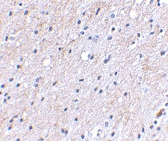 PAB13353 - NipSnap1