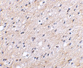 PAB13354 - NipSnap1