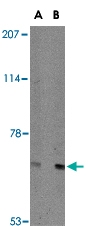 PAB13355 - AIF3 / AIFM3