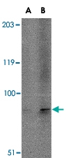 PAB13359 - TMC6 / EVER1