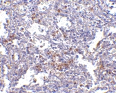 PAB13359 - TMC6 / EVER1