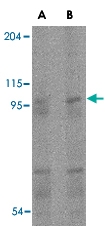 PAB13360 - TMC6 / EVER1