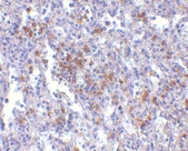 PAB13360 - TMC6 / EVER1
