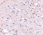 PAB13361 - AMBRA1