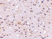 PAB13362 - AMBRA1