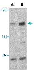 PAB13363 - CADPS