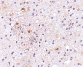 PAB13363 - CADPS
