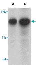 PAB13364 - CADPS