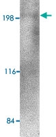 PAB13365 - RGPD5 / RGPD6