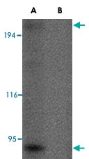 PAB13366 - RGPD5 / RGPD6