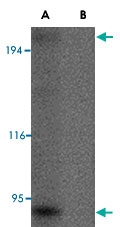 PAB13367 - GRTP1 / TBC1D6