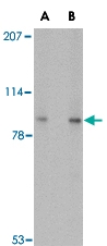PAB13369 - VPS53