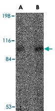 PAB13370 - VPS53