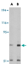 PAB13371 - Transportin-3 (TNPO3)