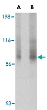 PAB13372 - Transportin-3 (TNPO3)