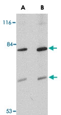 PAB13373 - TMC8