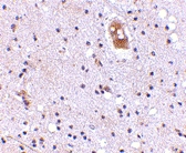 PAB13373 - TMC8
