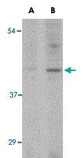 PAB13374 - SLC35D1 / UGTREL7