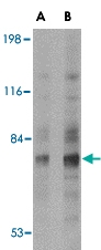 PAB13375 - Syntaphilin / SNPH