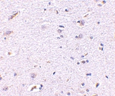 PAB13375 - Syntaphilin / SNPH