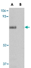 PAB13376 - SCARB2