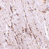 PAB13376 - SCARB2