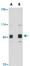 PAB13380 - Syntaphilin / SNPH