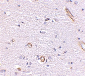 PAB13380 - Syntaphilin / SNPH