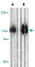 PAB13381 - HIV-1