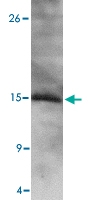 PAB13382 - NANOS2