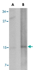 PAB13383 - NANOS2