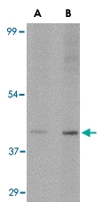 PAB13384 - SLC35D1 / UGTREL7