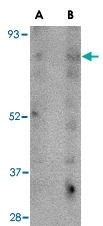 PAB13385 - SCARB2