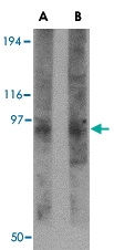 PAB13386 - TMC8