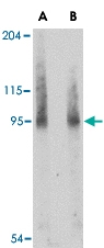 PAB13388 - BICD2