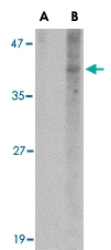 PAB13390 - NANOS1