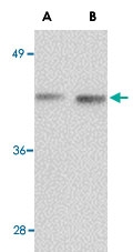 PAB13391 - NANOS1