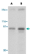PAB13392 - NUP107