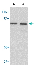 PAB13393 - NUP107