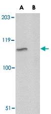 PAB13394 - Platelet glycoprotein VI