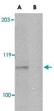 PAB13395 - Platelet glycoprotein VI