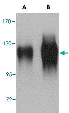 PAB13396 - HIV-1