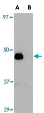PAB13397 - Interleukin-34 / IL34