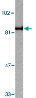 PAB13399 - IKKA