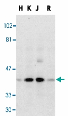 PAB13400 - DFFB / CAD