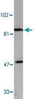 PAB13401 - IKKA